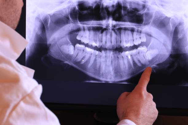 Best Root Canal Emergency Dentist  in Lyman, MS