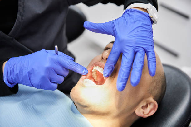 Emergency Gum Pain Relief in MS